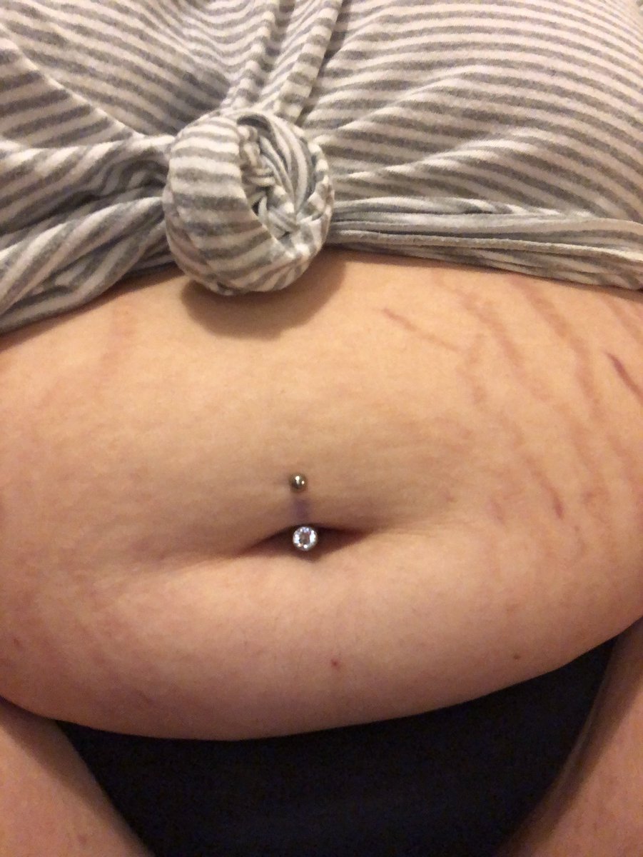 Navel-Piercing-on-fat-Stomach-18.jpg